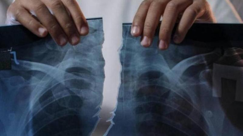 Person ripping x-ray of chest in half