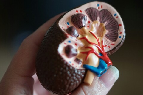 Model of kidney