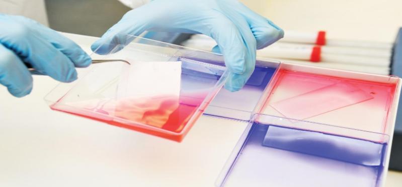 Image of cell plates in red and blue