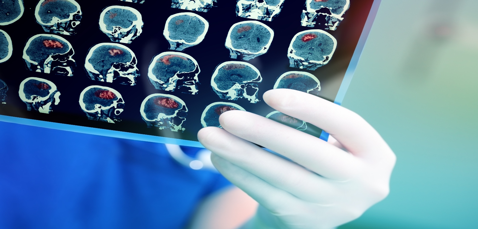 stock image of researcher looking at neurological scan