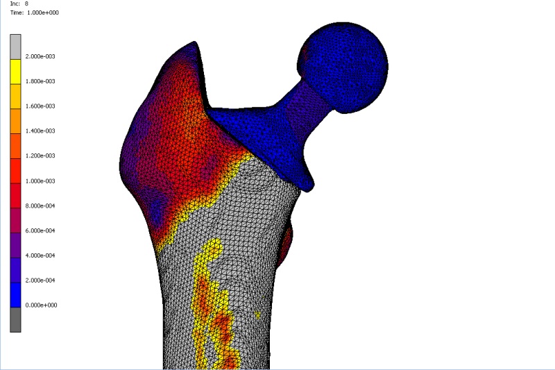 Simulated femur hip implant